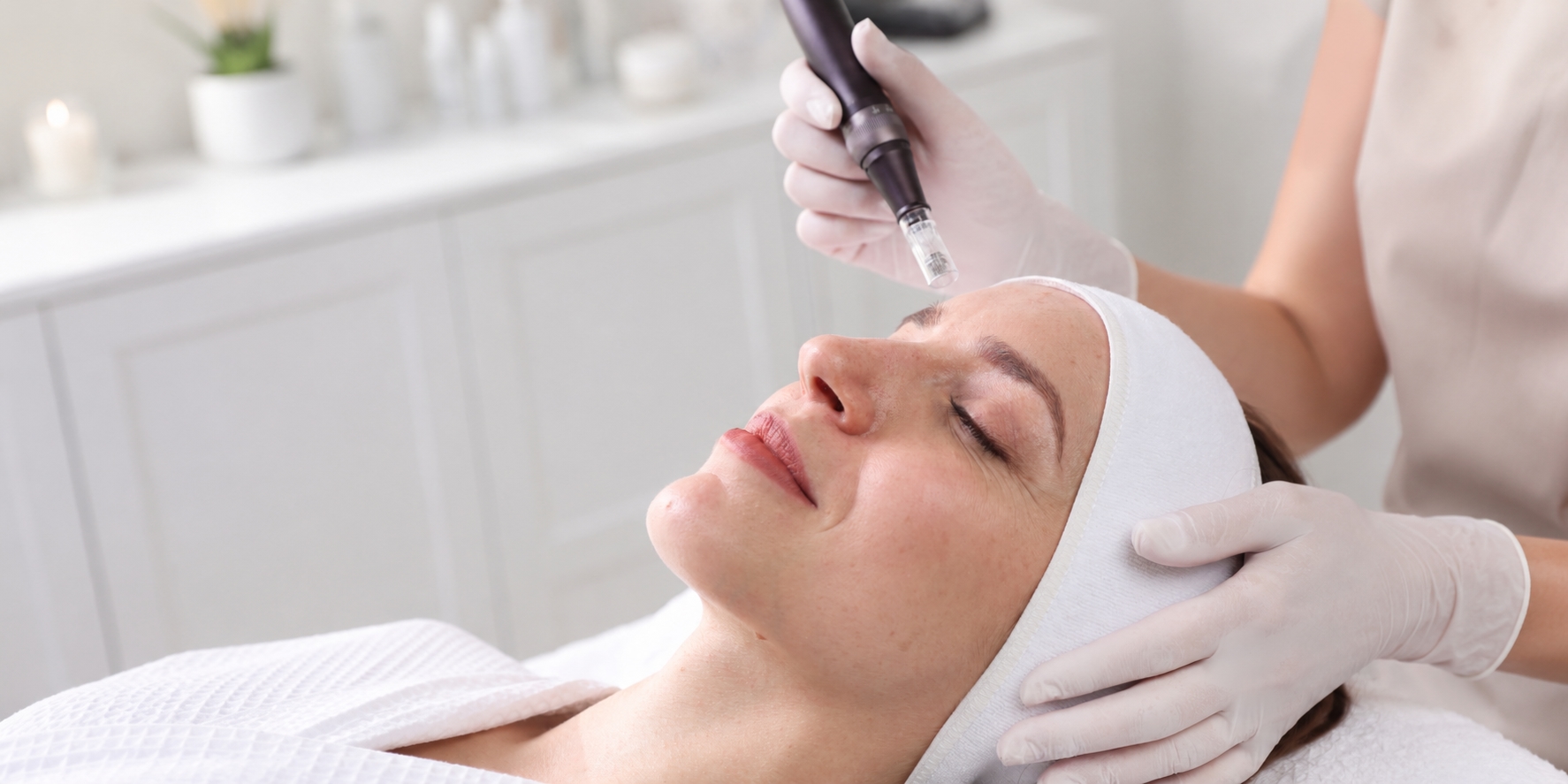 Microneedling
